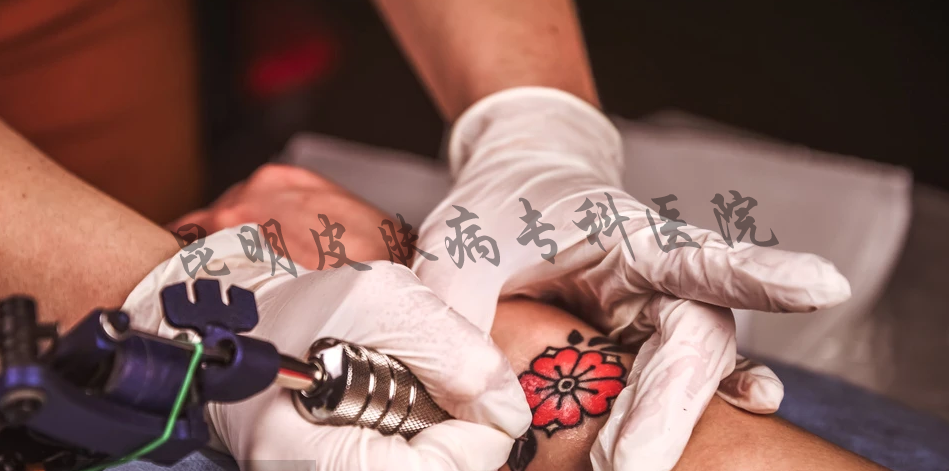 治疗纹身的疤痕去哪里