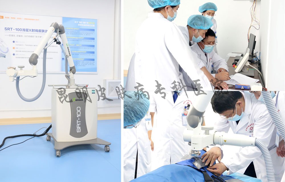 什么仪器治疗疤痕最厉害