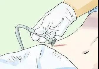 昆明疤痕病专家推荐 云南最权威的疤痕病医院