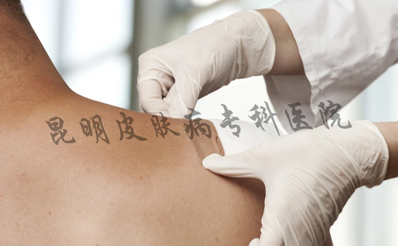 云南治疗疤痕好的医院 昆明看疤痕医院