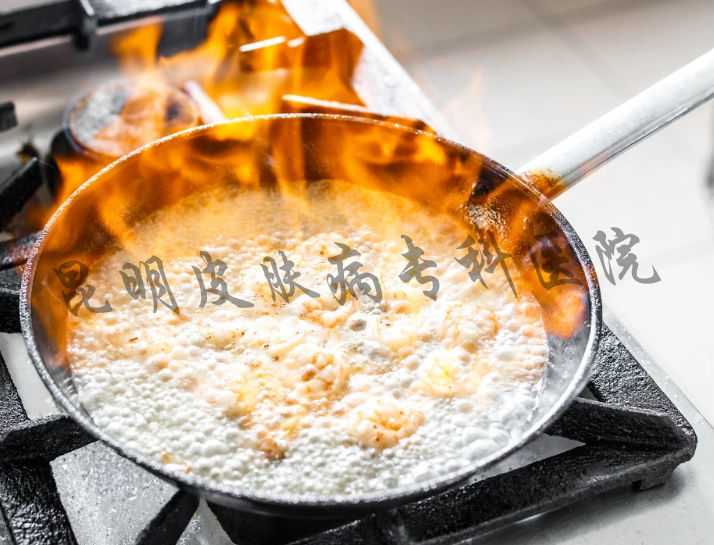 昆明医院疤痕病医院 昆明疤痕病医院比较好