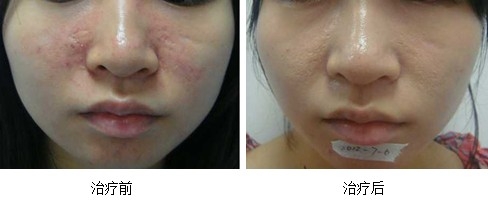 1627616544203900.jpg src=http _www.miraclelaser.com_upfile_201408200822417841.jpg&refer=http _www.miraclelaser.com&app=2002&size=f9999,10000&q=a80&n=0&g=0n&fmt=jpeg.jpg